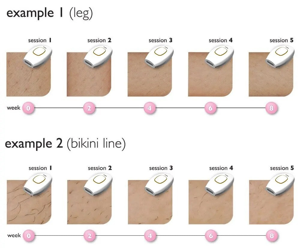 IPL ДЕПИЛАТОР СО ЛАСЕР
